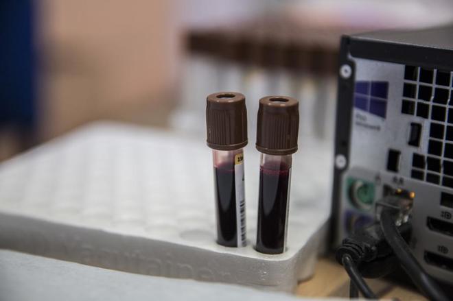 Resultado de imagen para análisis de sangre es capaz de detectar ocho tipos de cáncer