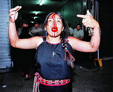 Una india mapuche herida en una protesta.|AP(archivo)