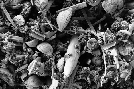 La 'super' bacteria polyextremo vista a través de un microscopio. | Reuters