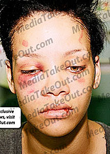 Rihanna golpeada. | mediatakeout.com