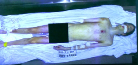 Imagen del cuerpo de Michael Jackson despus de morir. | Reuters
