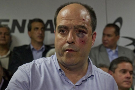 El diputado opositor Julio Borges tras la agresin.| Boris Vergara