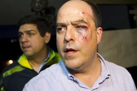 Julio Borges muestra sus lesiones.| Reuters