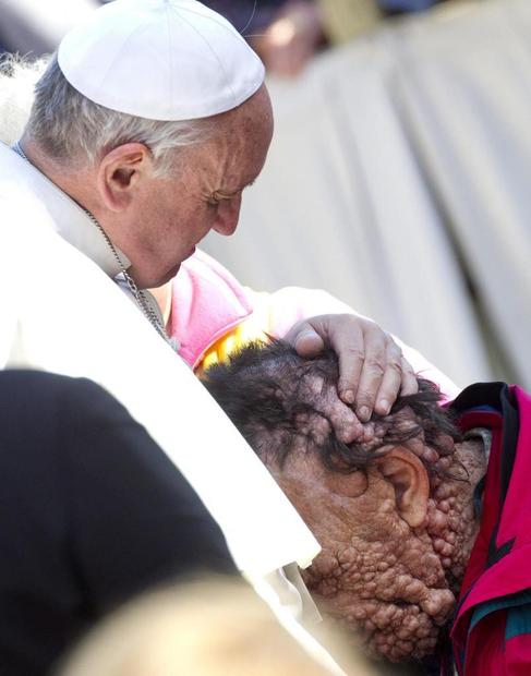 El Papa abraza a un enfermo tras la audiencia general de los...