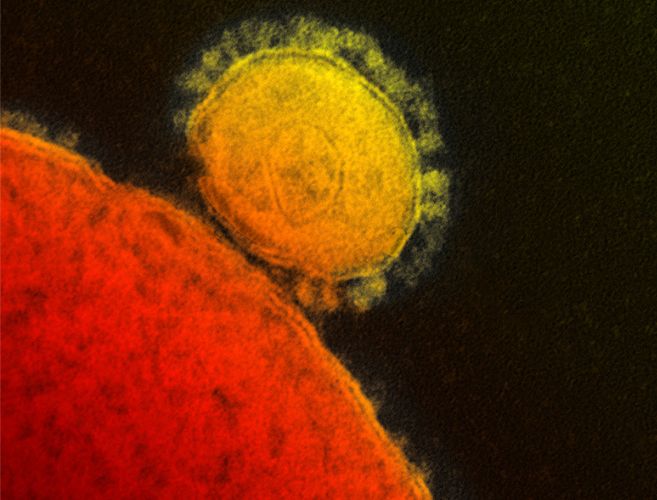 Imagen al microscopio del nuevo coronavirus