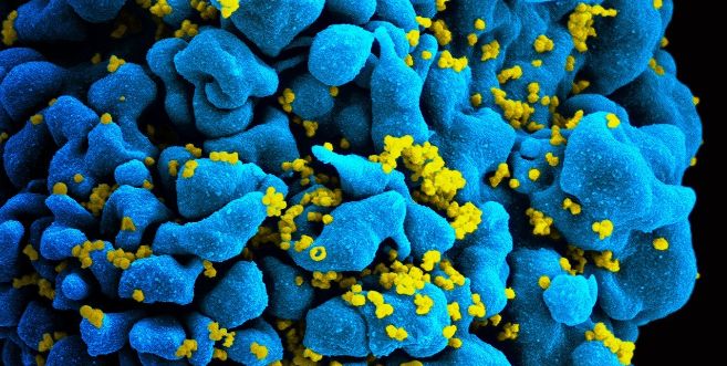 Detalle de una célula infectada por el VIH.