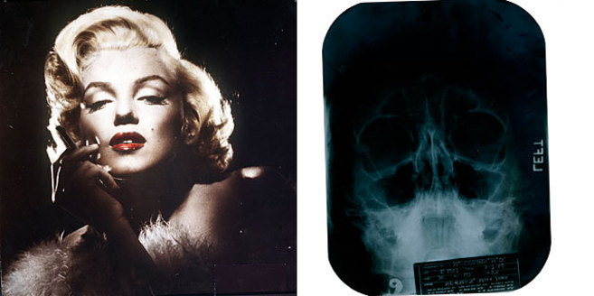 Marilyn y una radiografa de su rostro