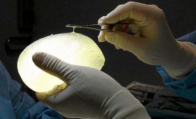 Un cirujano sujeta un implante de silicona PIP