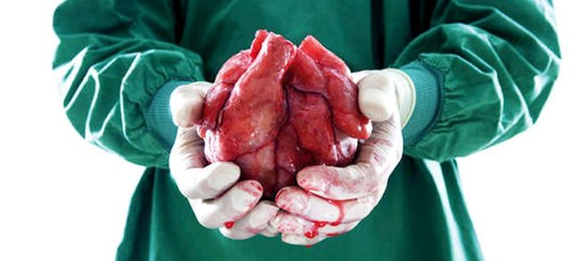 Un corazn humano listo para trasplante.