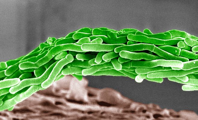Imagen del bacilo de la tuberculosis al microscopio