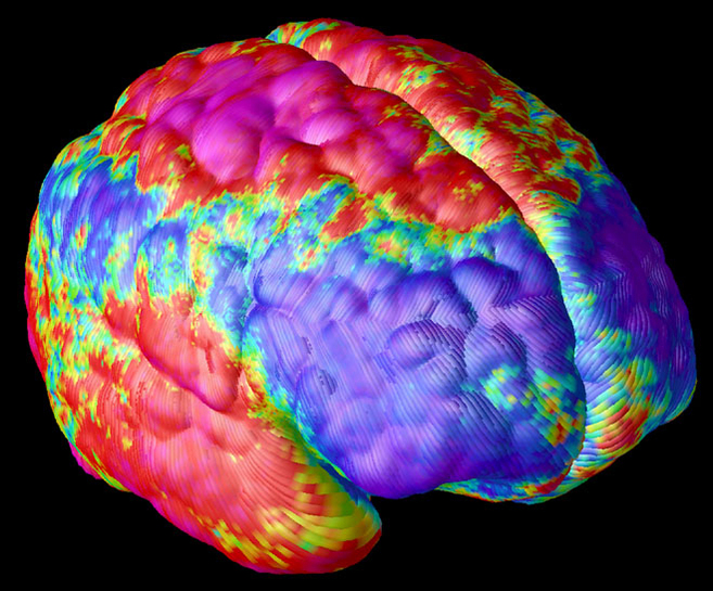 Imagen de una resonancia magnética del cerebro de un adolescente con...
