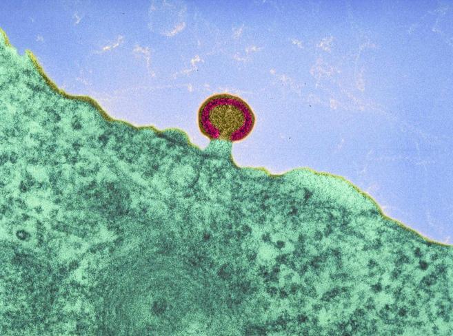 Imagen del virus del sida (en rojo) infectando una célula del sistema...