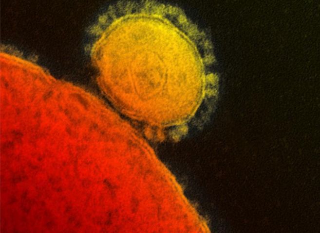 Imagen al microscopio del nuevo coronavirus.