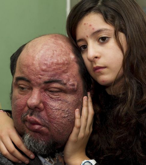 Luis junto a su hija, quien no deja de acariciarle.