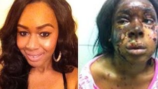 Naomi Oni, antes y despus de sufrir las graves quemaduras
