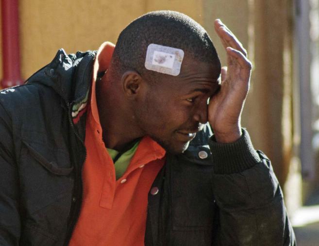 Un inmigrante con una herida cubierta en la cabeza permanece en el...