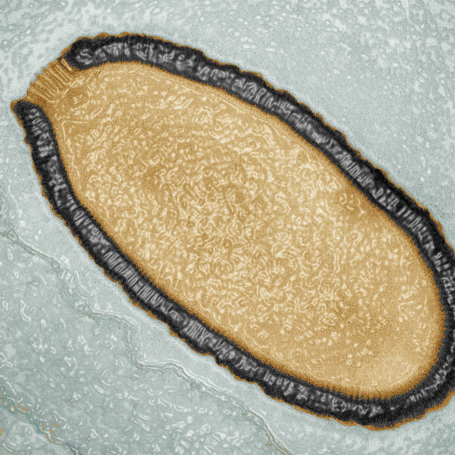 Imagen al microscopio de una ameba infectada por el virus gigante