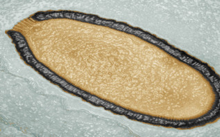 Imagen al microscopio de una ameba infectada por el virus.
