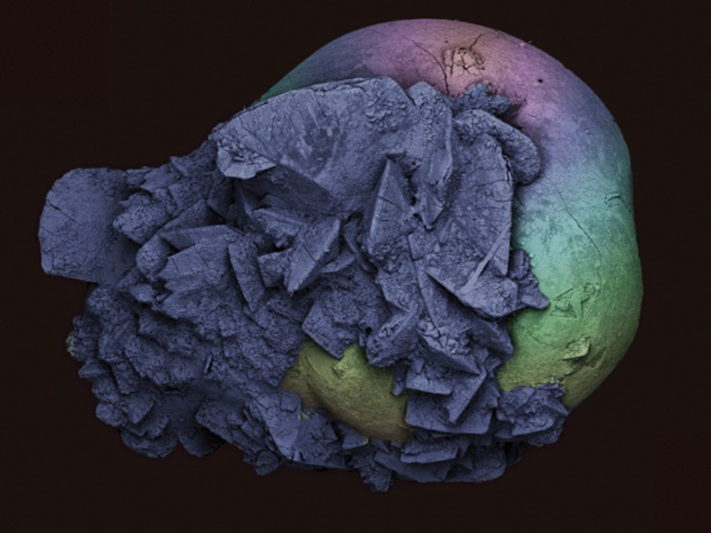 Imagen realizada a partir de un microscopio electrnico de una piedra...