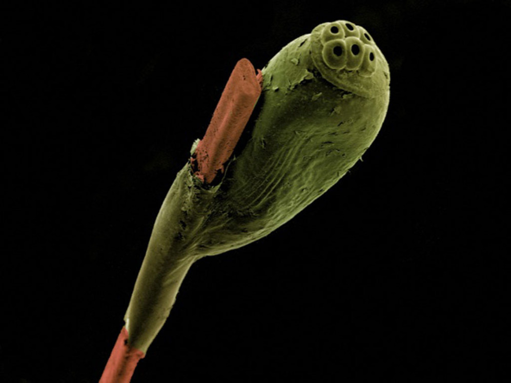 Imagen microscpica de una liendre adherida a un cabello humano.
