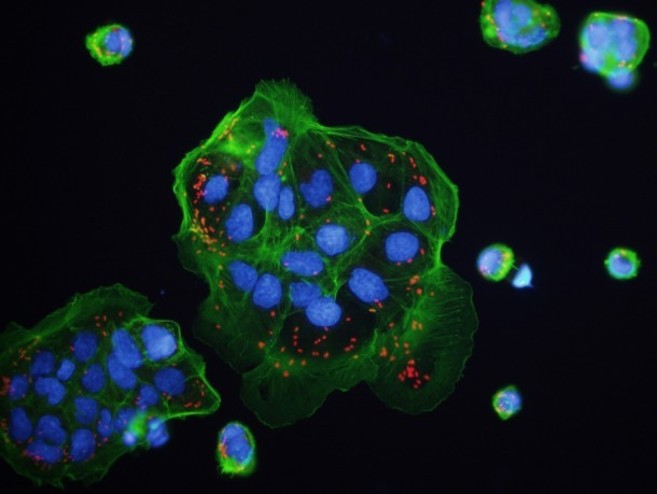 Imagen microscpica de clulas del sistema inmune.