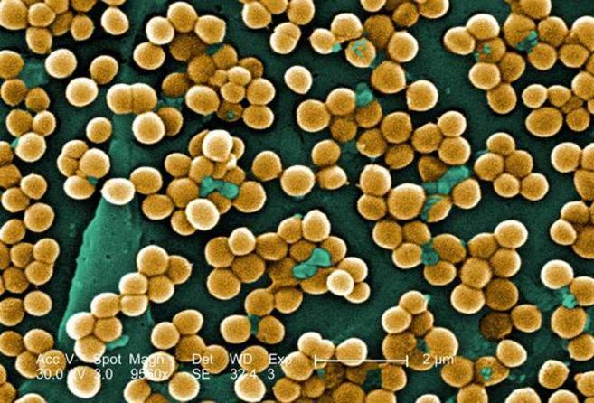 Las bacterias de Staphylococcus aureus pueden ser identificadas con el...