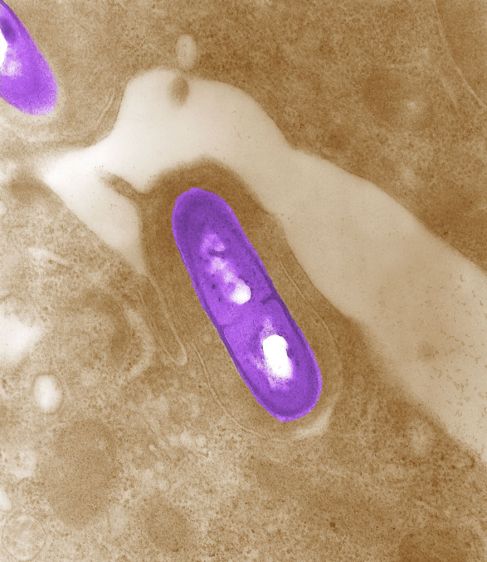 Imagen microscpica de la bacteria 'Listeria'.