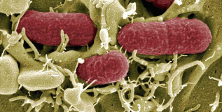 Imagen de una cepa de la bacteria Escherichia coli.