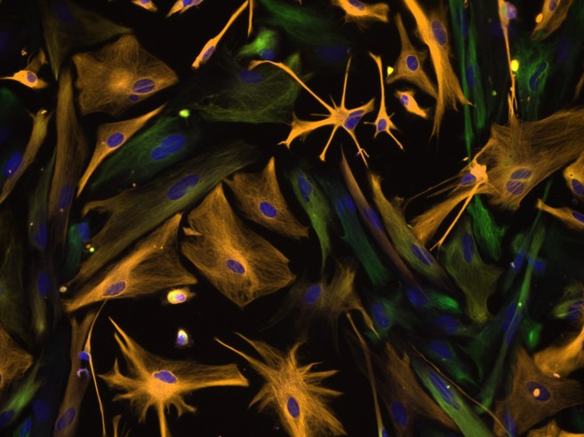 Clulas progenitoras de neuronas humanas aisladas en un cultivo.