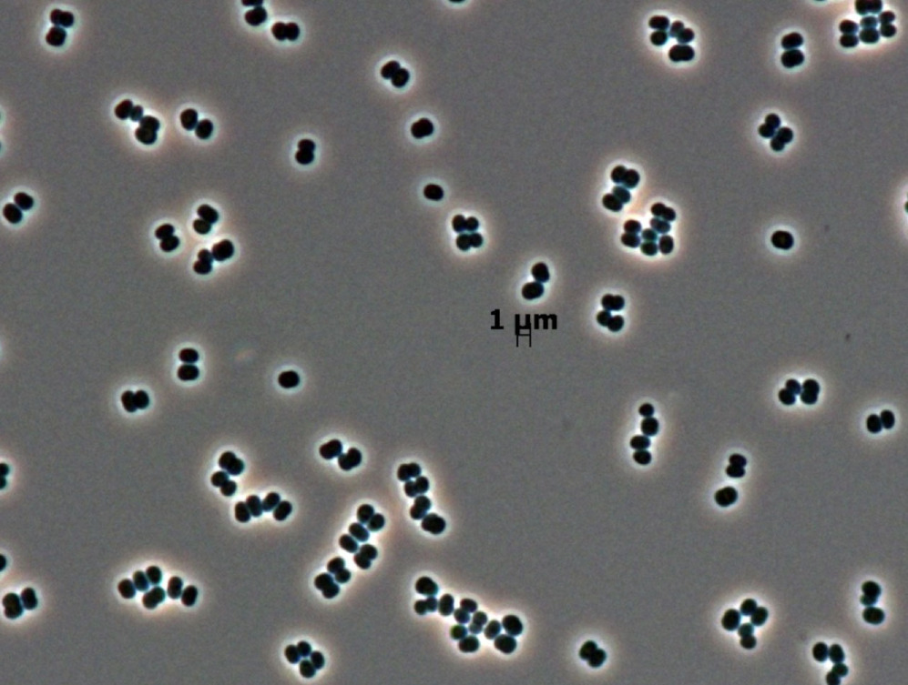 Tersicocus phoenicis, estos resistentes microbios fueron hallados en...