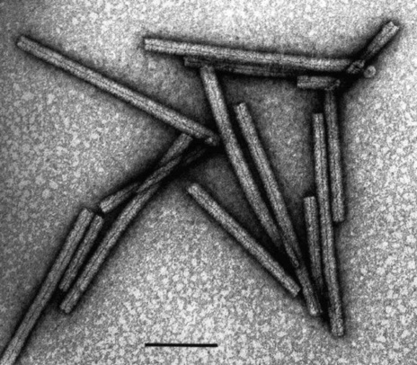 Virus del mosaico del tabaco: nanotubos naturales.