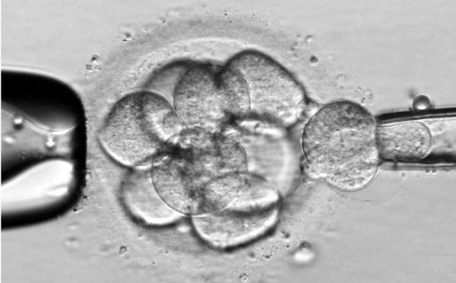 Divisin celular de un embrin humano
