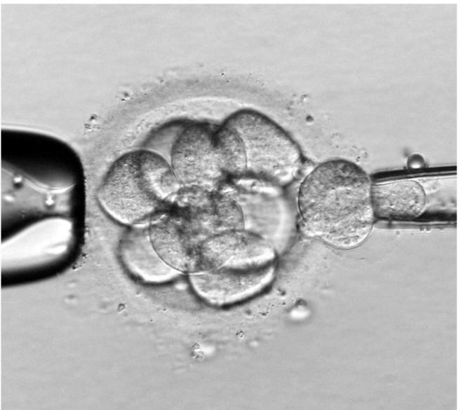 Detalle de la divisin celular de un embrin humano.
