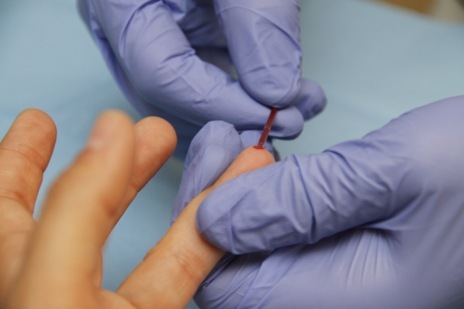 Momento de la extraccin de una pequea muestra de sangre.