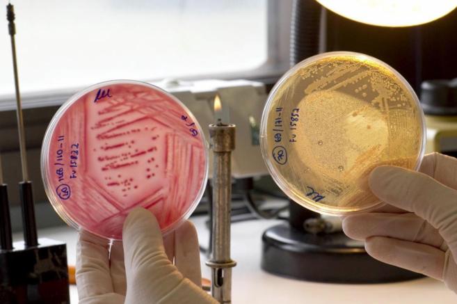 Cultivos bacterianos en placas de Petri.