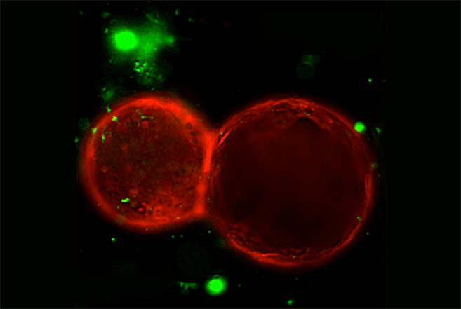 Células del estómago (en rojo) creciendo con células nerviosas (en...