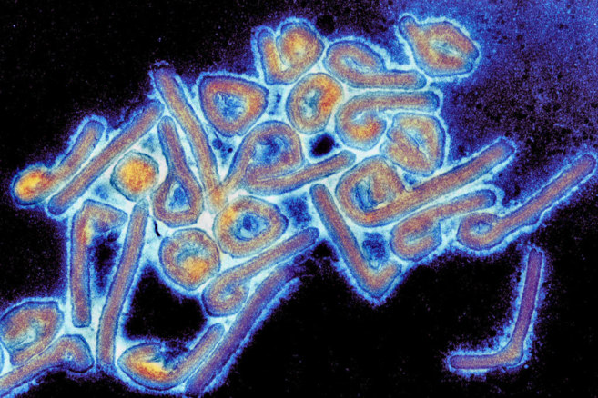 El virus de Marburgo bajo el microscopio.