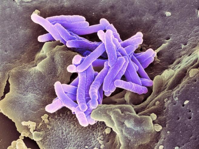 Bacilo de la tuberculosis, Mycobacterium tuberculosis'.