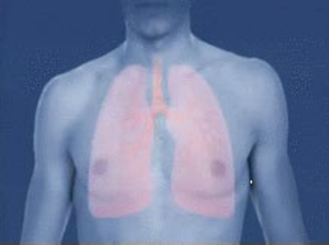 El asma colapsa las vías respiratorias en las personas que lo sufren.
