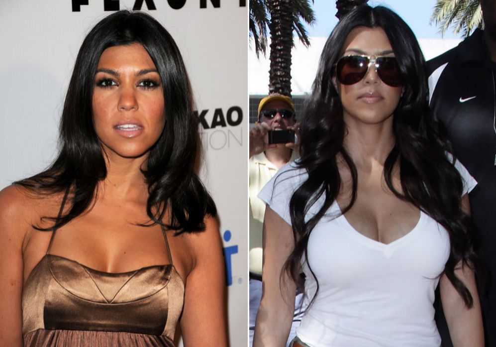 Kourtney Kardashian (35): Ha pasado de tener unos pechos naturales, a...
