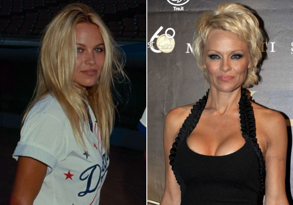 Pamela Anderson (47): Por todos es conocida como la mujer de los...