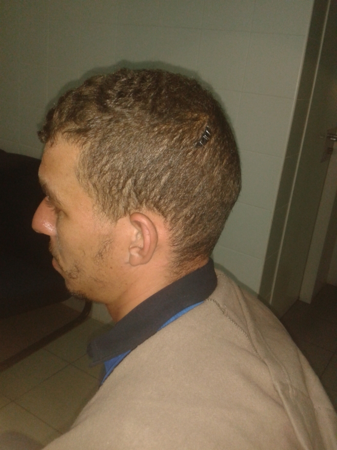 Uno de los internos agredidos muestra una brecha en la cabeza.