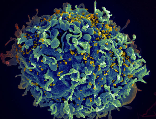 Partculas de VIH infectando una clula T, del sistema defensivo...
