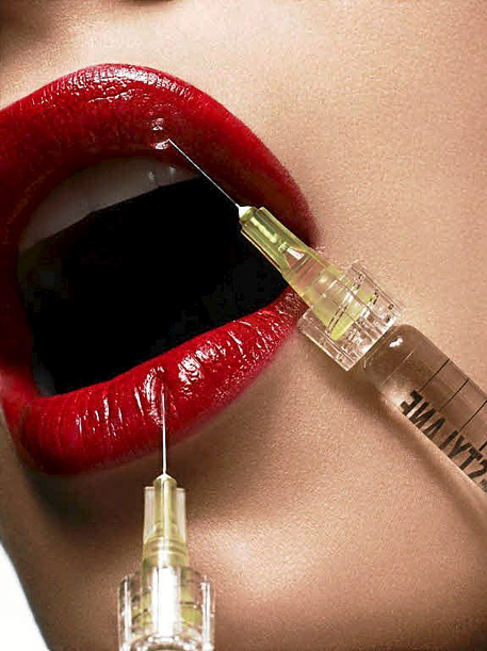 Inyeccciones de btox en los labios.