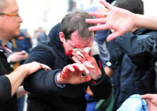 Un manifestante resulta herido tras los enfrentamientos.