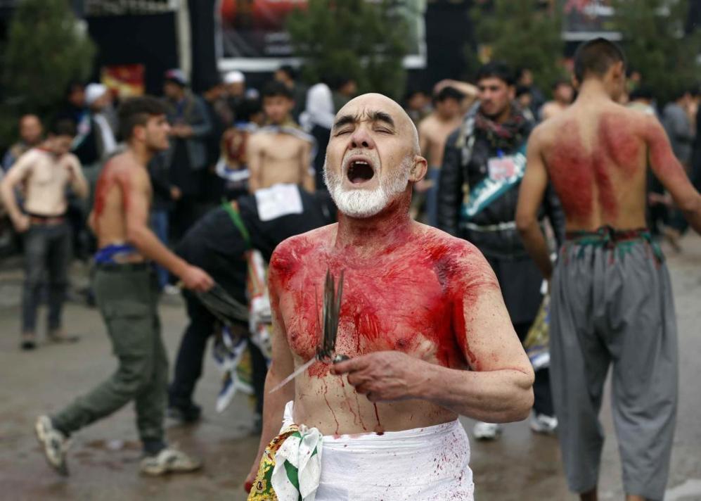 Un afgano de edad avanzada, con sangre en el pecho por los cortes y...