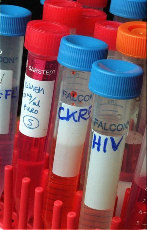 Muestras de VIH en un laboratorio.