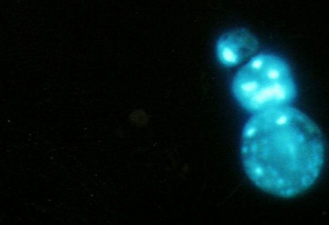 Imagen al microscopio de unos telómeros dañados