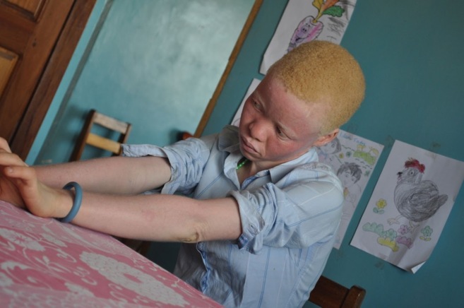 Un chico albino en Tanzania.