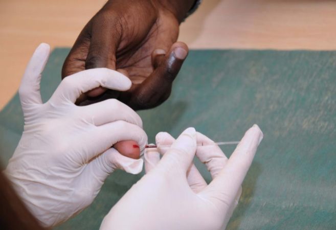 Una persona realizndose un test rpido de VIH.